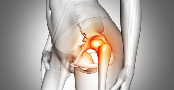 Queda e fratura do quadril em idosos: prevenção é fundamental