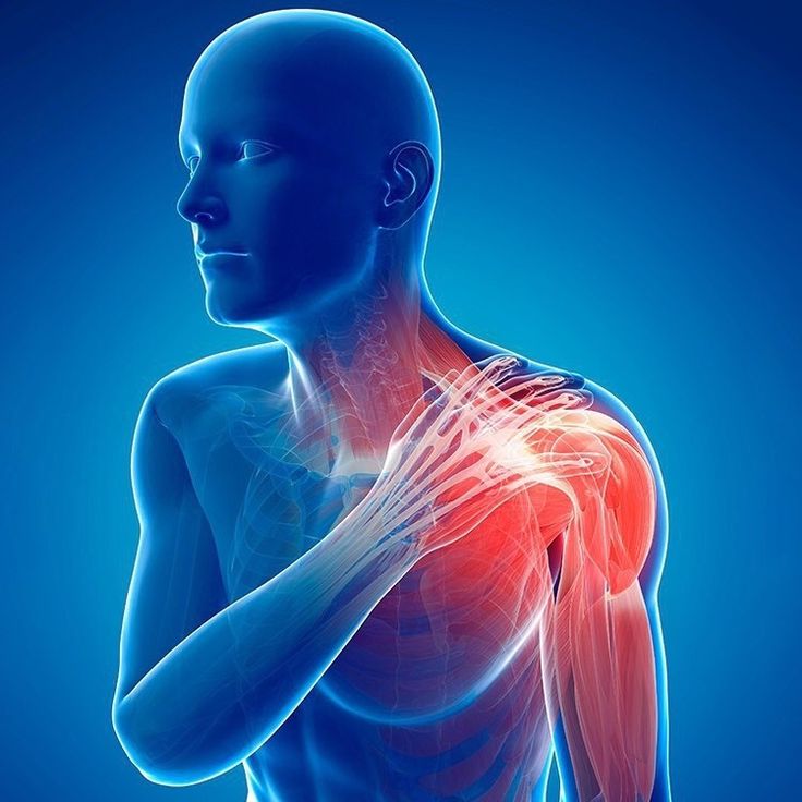 Quando a dor no ombro insiste: talvez o problema não esteja no ombro