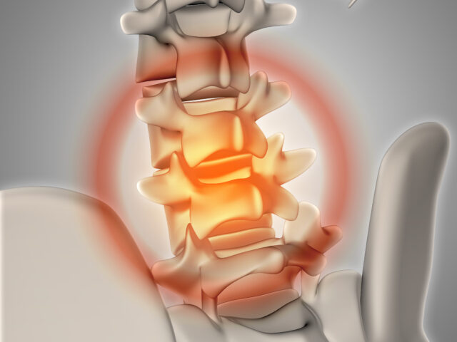 Descobri hérnia de disco… e agora?